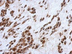 CCDC44 Antibody, Novus Biologicals 0.1mL; Unlabeled:Antibodies, Polyclonal