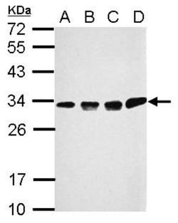 CCDC44 Antibody, Novus Biologicals 0.1mL; Unlabeled:Antibodies, Polyclonal
