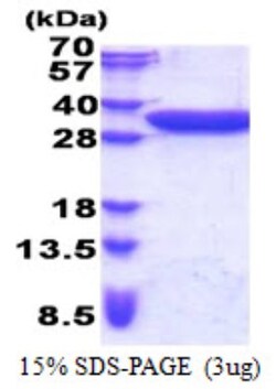 Novus Biologicals&trade;&nbsp;Recombinant Human CCDC44 His Protein