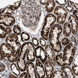CCDC44 Antibody, Novus Biologicals 25 &mu;L; Unlabeled:Antibodies, Polyclonal