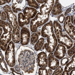 CCDC44 Antibody, Novus Biologicals:Antibodies:Primary Antibodies