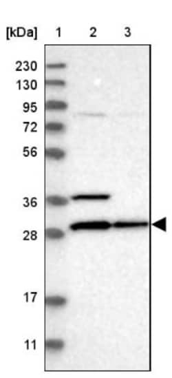 CCDC44 Antibody, Novus Biologicals 25 &mu;L; Unlabeled:Antibodies, Polyclonal