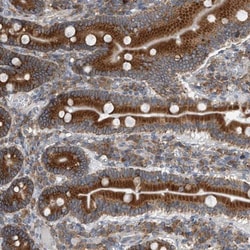 CCDC47 Antibody, Novus Biologicals 0.1mL; Unlabeled:Antibodies, Polyclonal