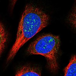CCDC4 Antibody, Novus Biologicals 25 &mu;L; Unlabeled:Antibodies, Polyclonal