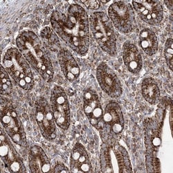 CCDC4 Antibody, Novus Biologicals 25 &mu;L; Unlabeled:Antibodies, Polyclonal