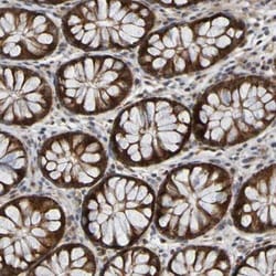 CCDC51 Antibody, Novus Biologicals:Antibodies:Primary Antibodies