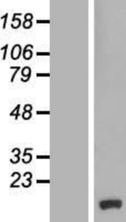 Novus Biologicals&trade;&nbsp;CCDC58 Overexpression Lysate