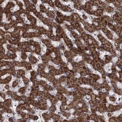 CCDC5 Antibody, Novus Biologicals:Antibodies:Primary Antibodies