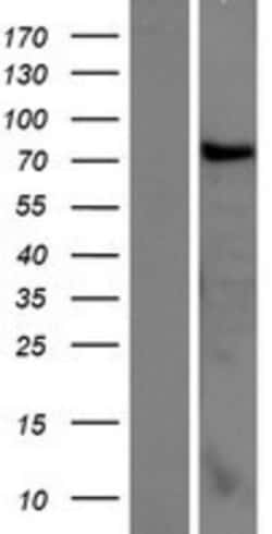 Novus Biologicals&trade;&nbsp;CCDC62 Overexpression Lysate