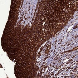 CCDC64B Antibody, Novus Biologicals 0.1mL; Unlabeled:Antibodies, Polyclonal