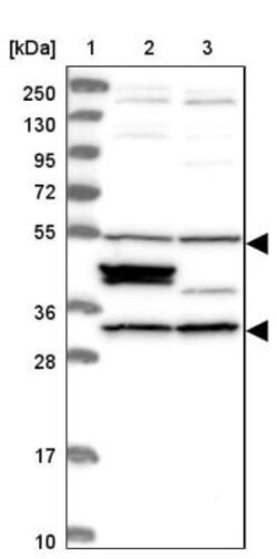 CCDC64B Antibody, Novus Biologicals 0.1mL; Unlabeled:Antibodies, Polyclonal