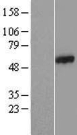 Novus Biologicals&trade;&nbsp;CCDC65 Overexpression Lysate