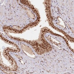 CCDC65 Antibody, Novus Biologicals:Antibodies:Primary Antibodies