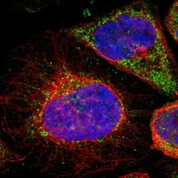 CCDC67 Antibody, Novus Biologicals:Antibodies:Primary Antibodies