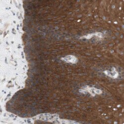 CCDC67 Antibody, Novus Biologicals:Antibodies:Primary Antibodies