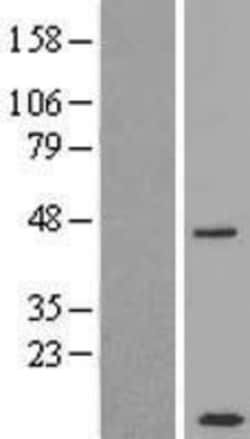 Novus Biologicals&trade;&nbsp;CCDC68 Overexpression Lysate