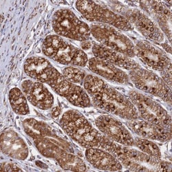 CCDC69 Antibody, Novus Biologicals:Antibodies:Primary Antibodies
