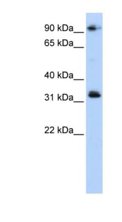 CCDC69 Antibody, Novus Biologicals:Antibodies:Primary Antibodies