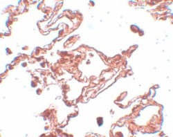 CCDC69 Antibody - BSA Free, Novus Biologicals 0.1mg; Unlabeled:Antibodies,