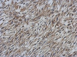 CCDC70 Antibody, Novus Biologicals 0.1mL; Unlabeled:Antibodies, Polyclonal