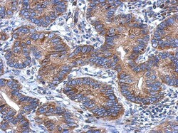 CCDC70 Antibody, Novus Biologicals 0.1mL; Unlabeled:Antibodies, Polyclonal