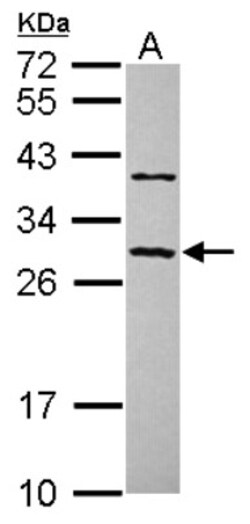 CCDC70 Antibody, Novus Biologicals 0.1mL; Unlabeled:Antibodies, Polyclonal