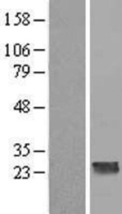 Novus Biologicals&trade;&nbsp;CCDC70 Overexpression Lysate