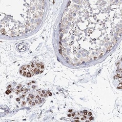 CCDC73 Antibody, Novus Biologicals:Antibodies:Primary Antibodies