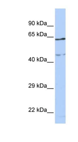 CCDC74A Antibody, Novus Biologicals:Antibodies:Primary Antibodies