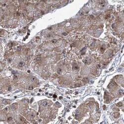 CCDC75 Antibody, Novus Biologicals:Antibodies:Primary Antibodies
