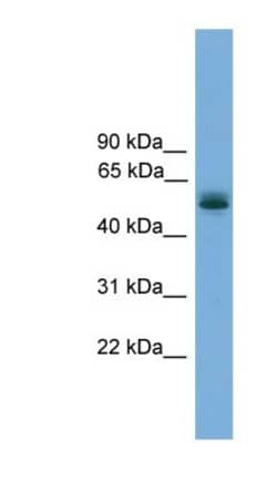 CCDC76 Antibody, Novus Biologicals 100&mu;L; Unlabeled:Antibodies, Polyclonal