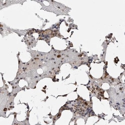 CCDC76 Antibody, Novus Biologicals 0.1mL; Unlabeled:Antibodies, Polyclonal