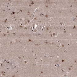 CCDC77 Antibody, Novus Biologicals:Antibodies:Primary Antibodies