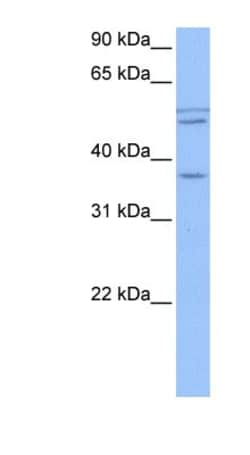 CCDC78 Antibody, Novus Biologicals 0.05mg; Unlabeled:Antibodies, Polyclonal