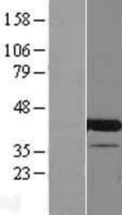 Novus Biologicals&trade;&nbsp;CCDC84 Overexpression Lysate