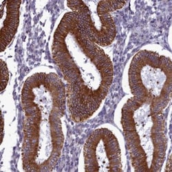 CCDC84 Antibody, Novus Biologicals 0.1mL; Unlabeled:Antibodies, Polyclonal