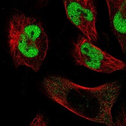 CCDC85A Antibody, Novus Biologicals:Antibodies:Primary Antibodies