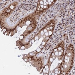 CCDC85A Antibody, Novus Biologicals:Antibodies:Primary Antibodies