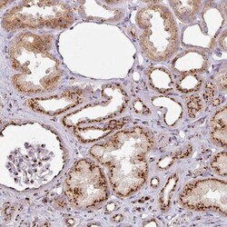 CCDC85B Antibody, Novus Biologicals:Antibodies:Primary Antibodies