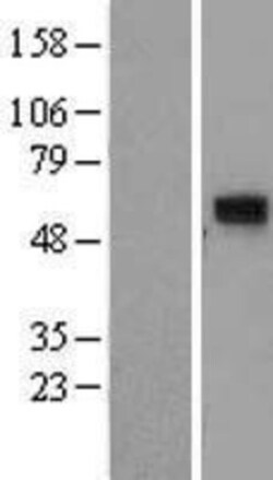 Novus Biologicals&trade;&nbsp;CCDC86 Overexpression Lysate