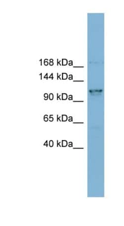 CCDC87 Antibody, Novus Biologicals:Antibodies:Primary Antibodies