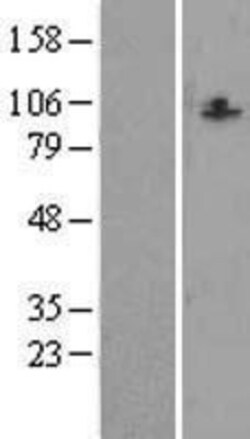 Novus Biologicals&trade;&nbsp;CCDC87 Overexpression Lysate