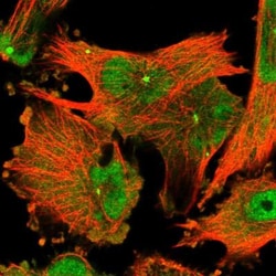 CCDC88B Antibody, Novus Biologicals:Antibodies:Primary Antibodies
