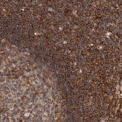 CCDC88B Antibody, Novus Biologicals:Antibodies:Primary Antibodies