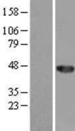 Novus Biologicals&trade;&nbsp;CCDC89 Overexpression Lysate