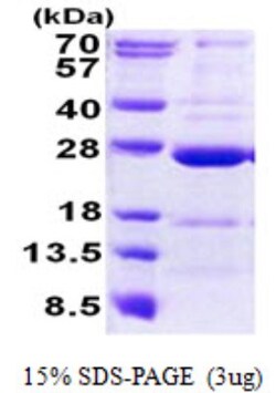 Novus Biologicals&trade;&nbsp;Recombinant Human CCDC90B His Protein