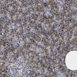CCDC90B Antibody, Novus Biologicals 25 &mu;L, Unlabeled:Antibodies, Polyclonal