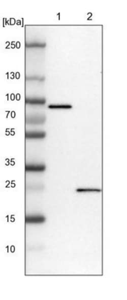 CCDC90B Antibody, Novus Biologicals 0.1mL; Unlabeled:Antibodies, Polyclonal