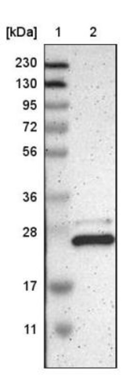 CCDC90B Antibody, Novus Biologicals 0.1mL; Unlabeled:Antibodies, Polyclonal