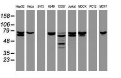 CCDC93 Antibody (OTI6E11), Novus Biologicals 0.1mL; Unlabeled:Antibodies,